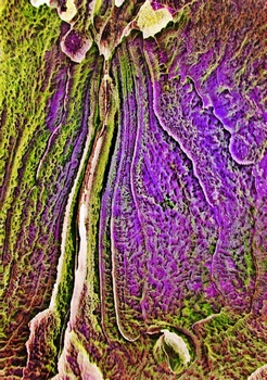 A 11D